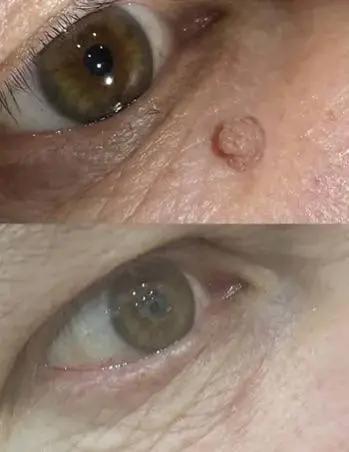 Фото до и после