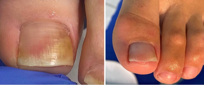 Фото ДО лечения