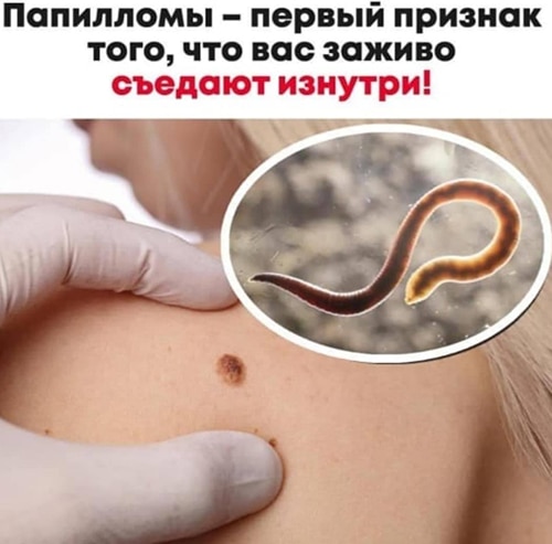 Сравнение здорового и зараженного организма