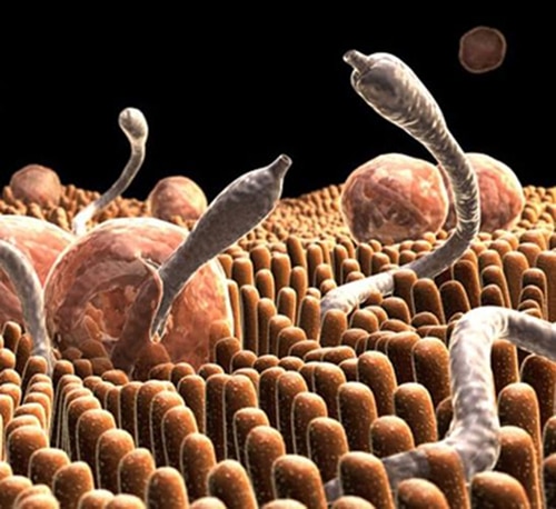 Иллюстрация папилломы