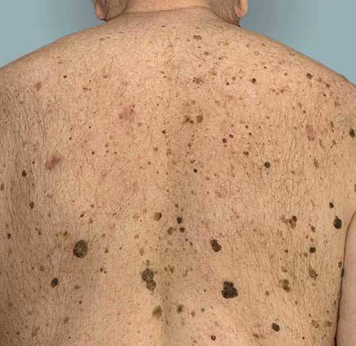 Владимир Винокур в больнице