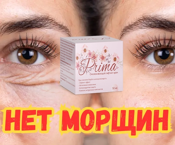 Сравнение Prima с аналогами