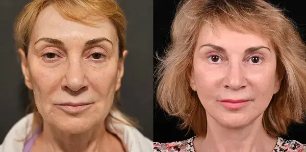 Марина Зубова, г. Петропавловск