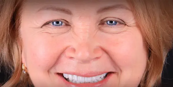 Красота, которая изменила судьбу!