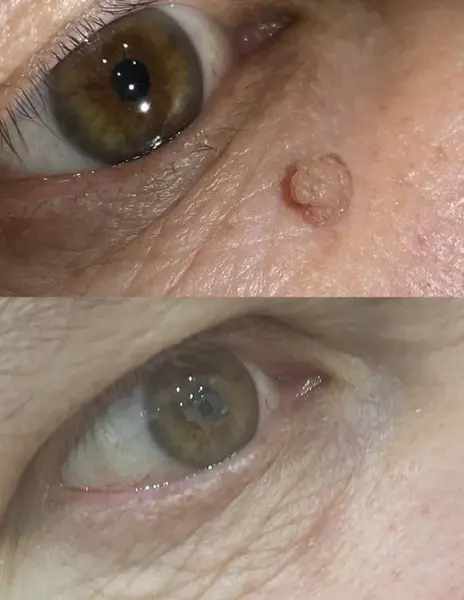 Фото до лечения