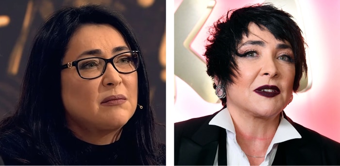 Лолита Милявская до использования средства